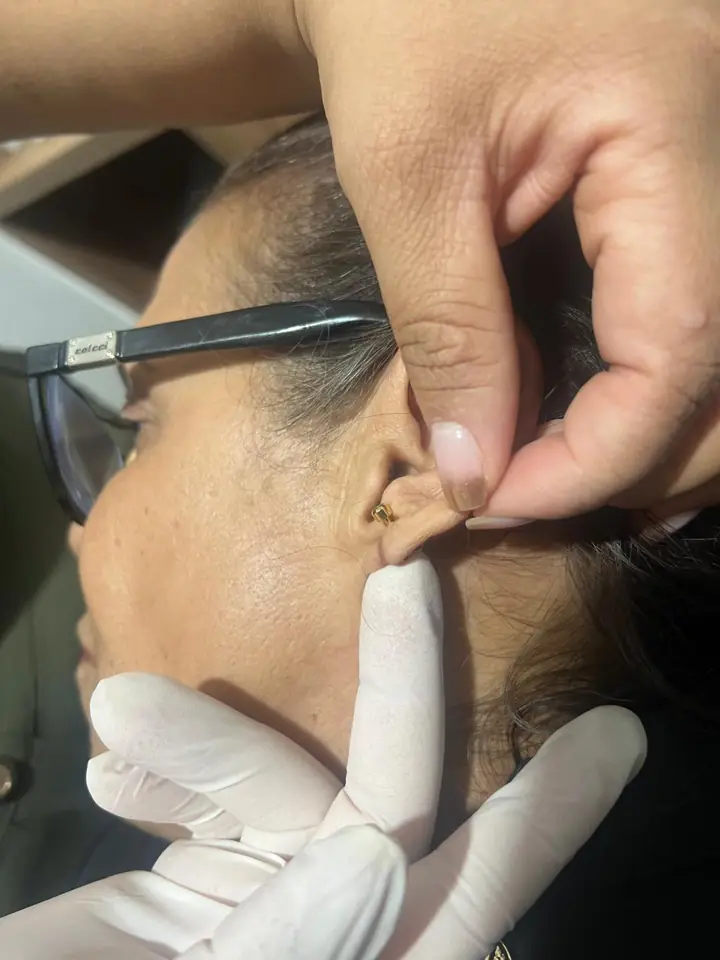 Fran Gomes, body piercer especialista em lobuloplastia em Sua Cidade